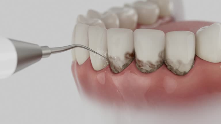 Reliable Dental Implants contractor in Cherryvale, SC by Smile Center Dentistry